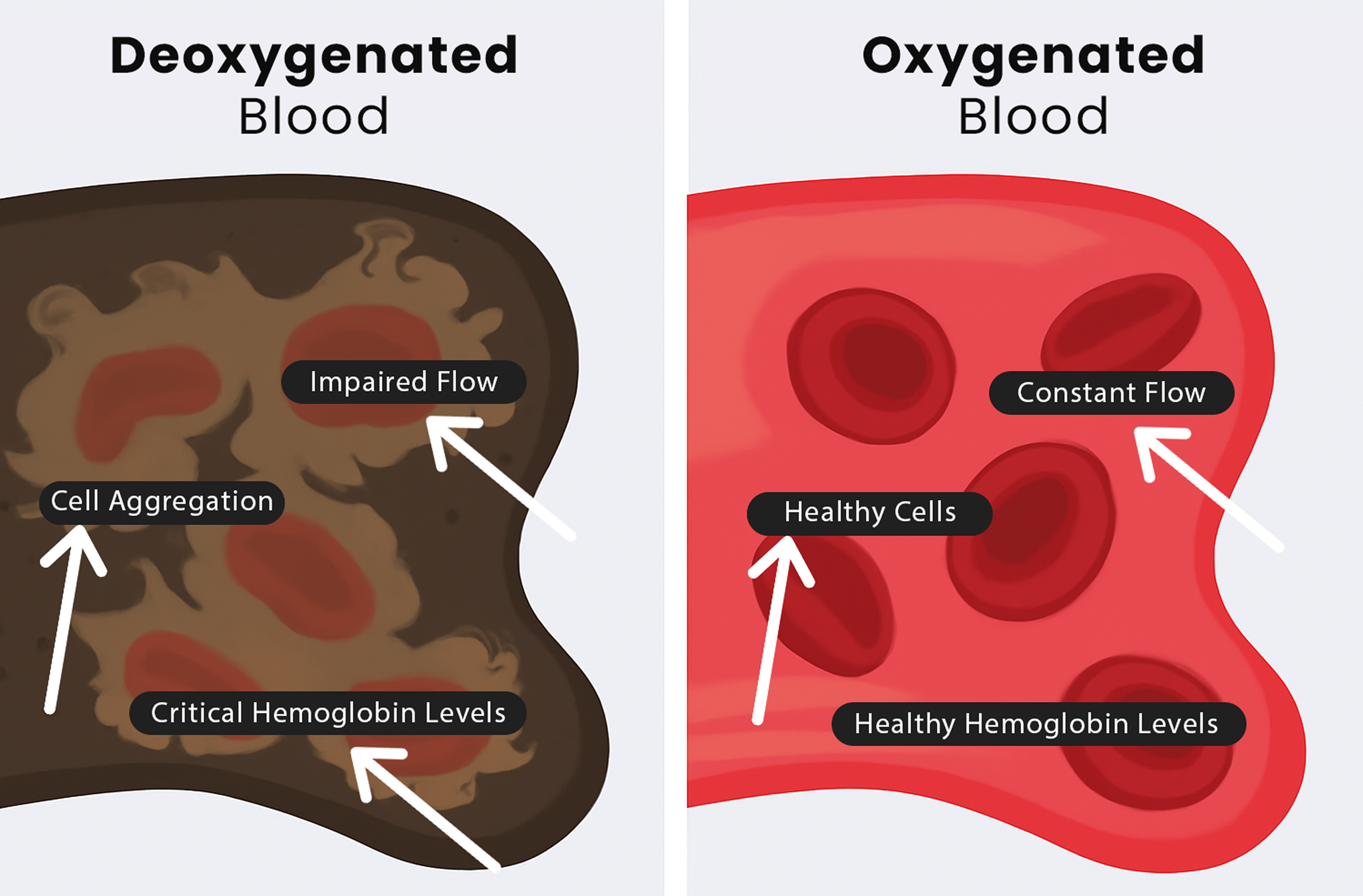 Comparación de flujo saludable vs alterado